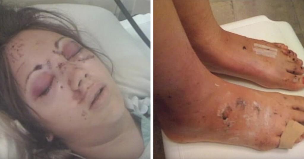Årsaken til at kvinnen endte opp med disse skadene er virkelig sjokkerende