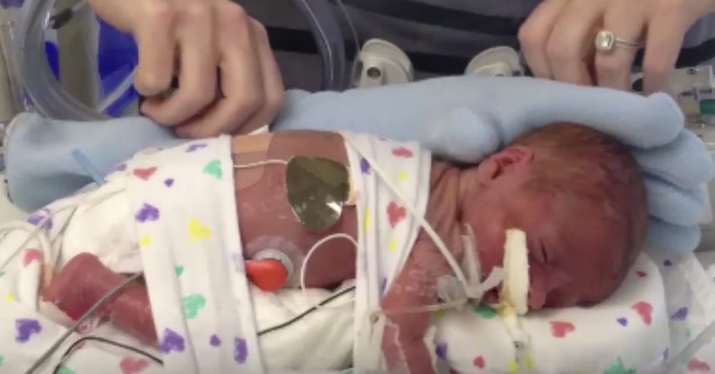 Hun legger en hvit hanske på den for tidlig fødte babyen. Da gråter sykepleierne